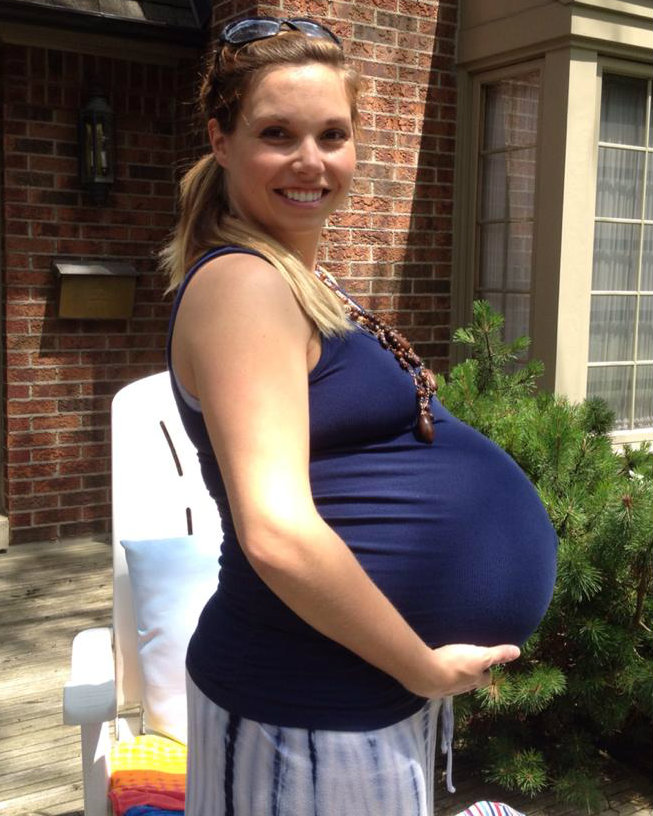 Twin Pregnancy 36 Weeks
